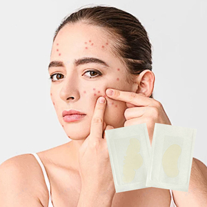 Private Label Whitehead Remover Patch Nose Cheek Chin Forehead